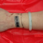 Examination of Chinese woman