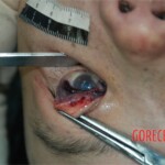 Strangled and raped girl