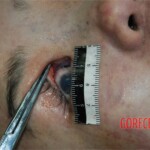 Strangled and raped girl