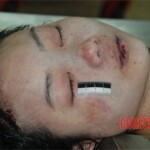 Strangled and raped girl