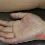 Strangled and raped girl