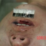 Strangled and raped girl