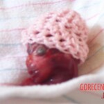 aborted fetus
