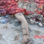 Crushed Palestinian captive