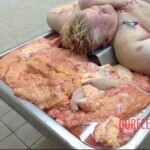 Autopsy of obese woman