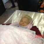 Autopsy of obese woman