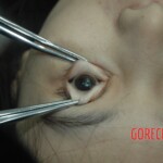 Dead drugged pregnant woman