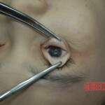 Dead drugged pregnant woman