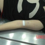 Dead drugged pregnant woman