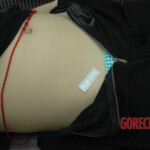 Dead drugged pregnant woman