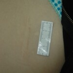 Dead drugged pregnant woman