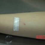 Dead drugged pregnant woman