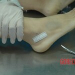 Dead drugged pregnant woman