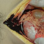 Dead drugged pregnant woman