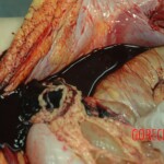 Dead drugged pregnant woman