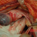 Dead drugged pregnant woman