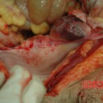 Dead drugged pregnant woman