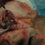 Dead drugged pregnant woman