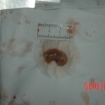 Dead drugged pregnant woman