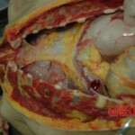 Dead drugged pregnant woman