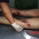 Russian girl suicide