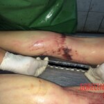 Russian girl suicide