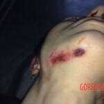 Russian girl suicide