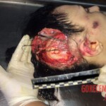 Russian girl suicide