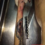 Russian girl suicide