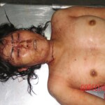 Raped and stabbed girl