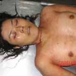 Raped and stabbed girl