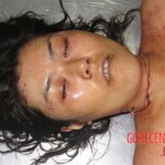 Raped and stabbed girl