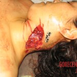 Raped and stabbed girl