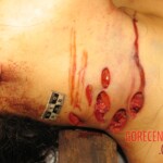 Raped and stabbed girl