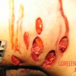 Raped and stabbed girl