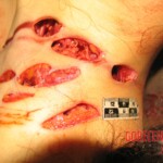 Raped and stabbed girl