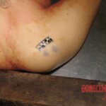 Raped and stabbed girl