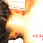 Raped and stabbed girl