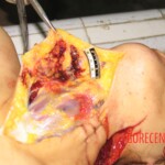 Raped and stabbed girl