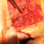 Raped and stabbed girl