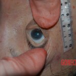 Raped and murdered chick