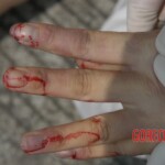 Raped young woman chooses suicide