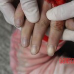 Raped young woman chooses suicide