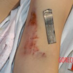 Raped young woman chooses suicide