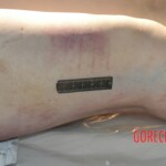 Raped young woman chooses suicide