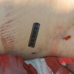 Raped young woman chooses suicide