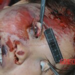 Raped young woman chooses suicide