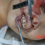 Raped young woman chooses suicide