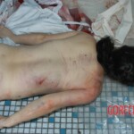 Raped young woman chooses suicide