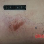 Raped young woman chooses suicide